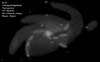� M. D�hne; Messier 33
